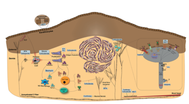 瘢痕疙瘩瘙痒的重要性