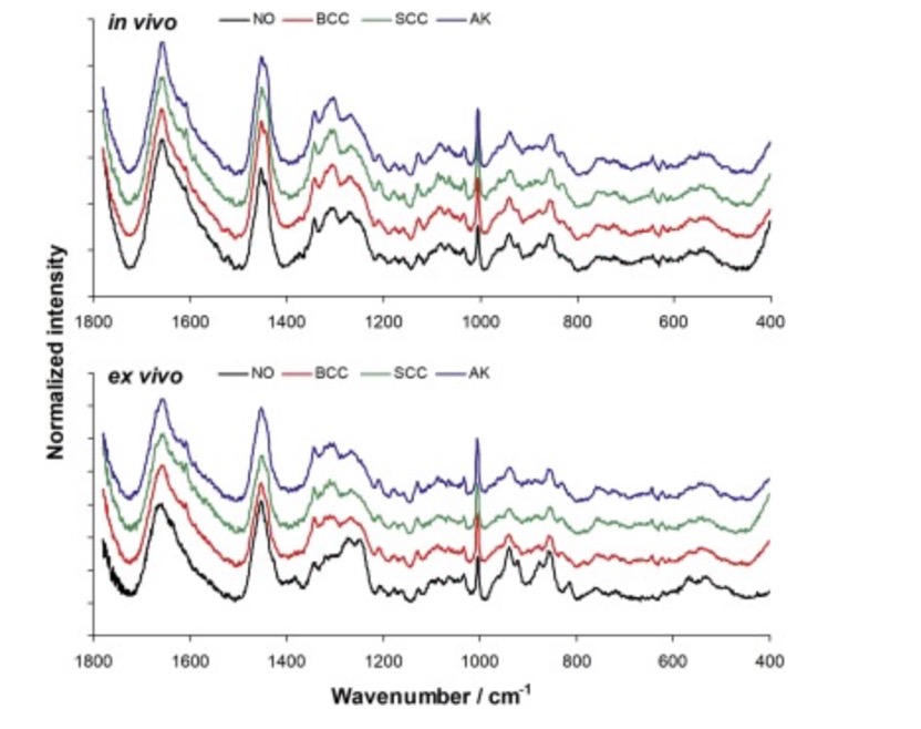 诊断鉴别皮肤病的方法