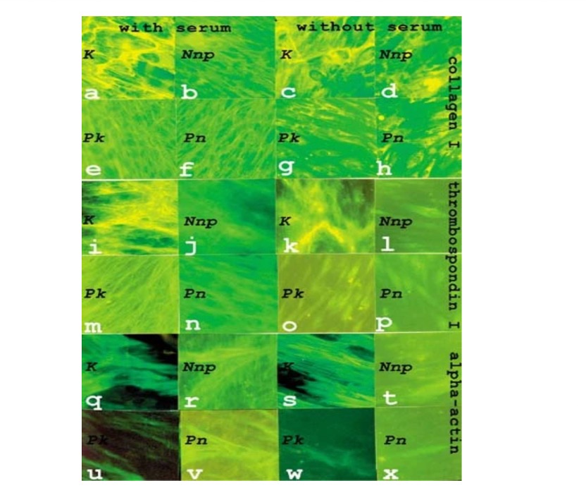 体外瘢痕细胞和手掌成纤维细胞中的肌纤维细胞表型和凋亡