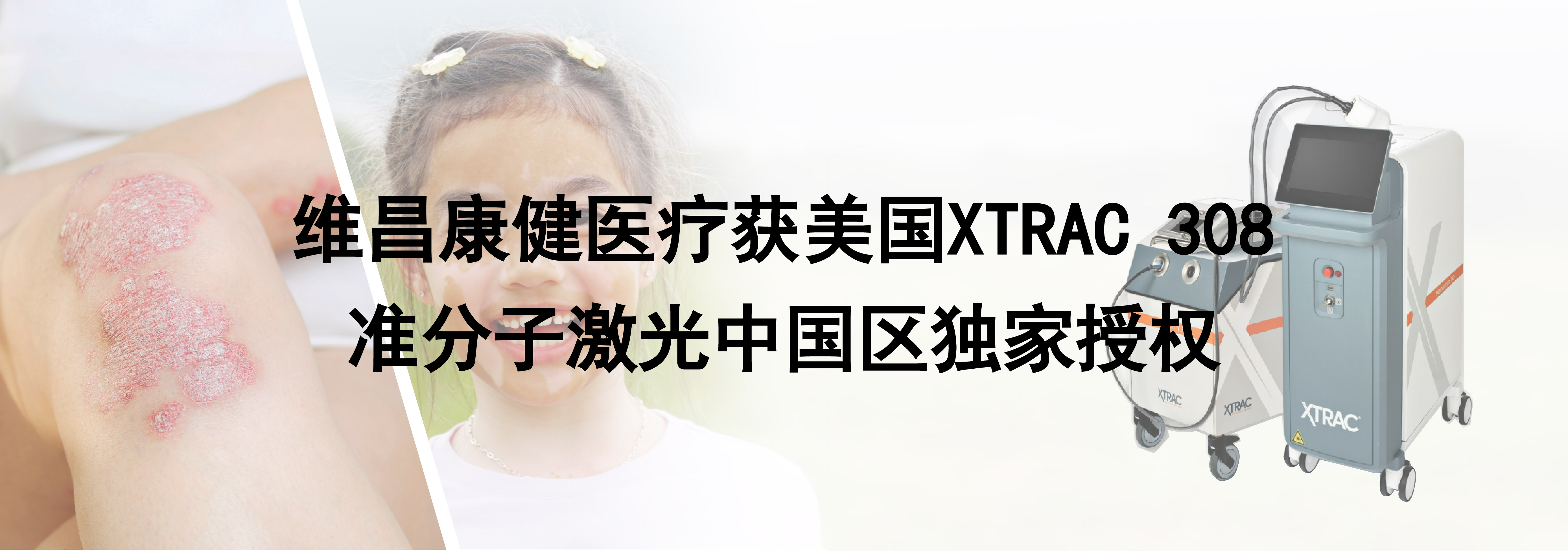 SRT-100放射治疗仪  浅层放射治疗系统./uploadpic/image/202605/20260521084752_86731.jpg